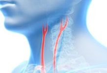 En Tehlikeli 4 Damar Hastalığı