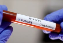 Koronavirüs Nedir: Kovid-19 Belirtileri Neler, Türkiye’de Vaka Var Mı? Koronavirüs nedir: Kovid-19 belirtileri neler, Türkiye'de vaka var mı?