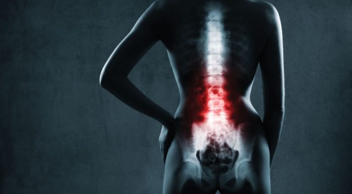 Omurganızı Korumak İçin Evde Yapabileceğiniz 4 Egzersiz Omurganızı Korumak İçin Evde Yapabileceğiniz 4 Egzersiz