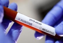 Beş Farklı Sigorta Şirketi, Koronavirüs Tedavisini Kapsamına Aldı Beş Farklı Sigorta Şirketi, Koronavirüs Tedavisini Kapsamına Aldı