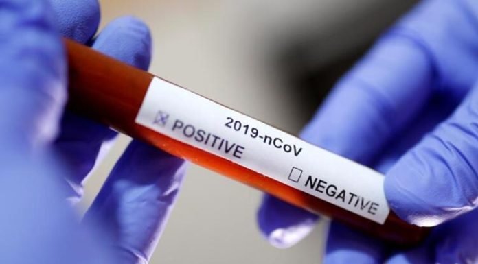 Beş Farklı Sigorta Şirketi, Koronavirüs Tedavisini Kapsamına Aldı Beş Farklı Sigorta Şirketi, Koronavirüs Tedavisini Kapsamına Aldı