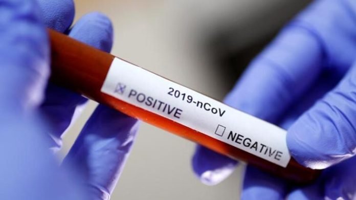 Beş Farklı Sigorta Şirketi, Koronavirüs Tedavisini Kapsamına Aldı