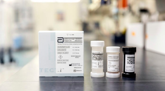 Koronavirüsle Mücadelede Yeni Antikor Testi Artık Türkiye’de Koronavirusle Mucadelede Yeni Antikor Testi Artik Turkiye’de