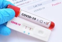 Rektör, Yardımcıları, Özel Kalem, Korumalar! Hepsinin Testi Pozitif Çıktı! Rektor, yardimcıiari, ozel kalem, korumalar Hepsinin testi pozitif cikti