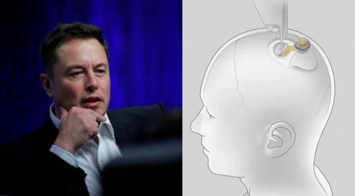 Musk’ın Beyin Kontrol Eden Çipi Neuralink’ten Korkmalı Mıyız?