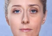 Göz Altı Torbası Neden Oluşur, Nasıl Tedavi Edilir?