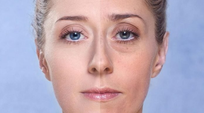 Göz Altı Torbası Neden Oluşur, Nasıl Tedavi Edilir?