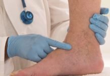 Hareketsizlik Hastalığı: Varisten Korunmanın Yolları