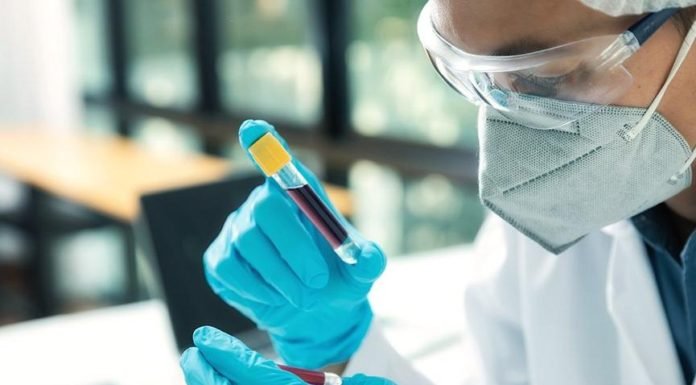 Covıd-19’da Hangi Test Ne Kadar Güvenilir Sonuç Veriyor? Covıd-19’da Hangi Test Ne Kadar Guvenilir Sonuc Veriyor