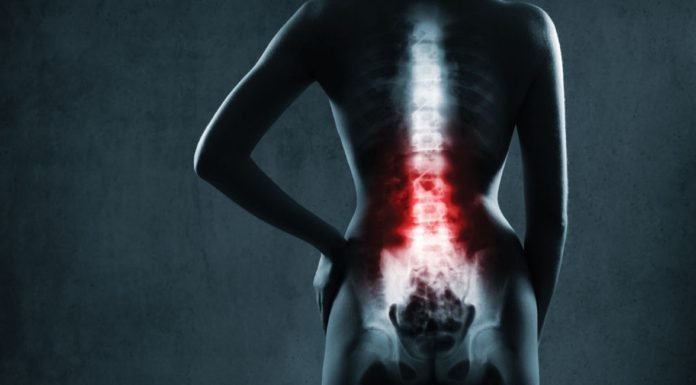 Omurga ve Bel Sağlığını Korumanın Yolları