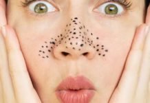 Burunda Oluşan Siyah Noktalar Nasıl Geçer?