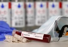 İki Yeni Koronavirüs Araştırmasına Göre Kan Grubu 0 Olanların Riski Daha Düşük İki Yeni Koronavirus Arastirmasina Gore Kan Grubu 0 Olanlarin Riski Daha Dusuk