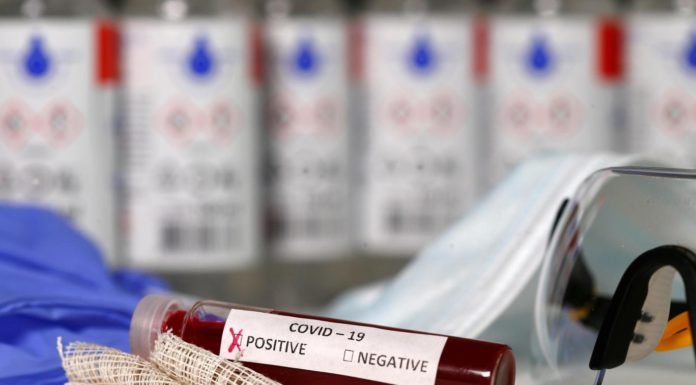 İki Yeni Koronavirüs Araştırmasına Göre Kan Grubu 0 Olanların Riski Daha Düşük İki Yeni Koronavirus Arastirmasina Gore Kan Grubu 0 Olanlarin Riski Daha Dusuk