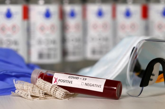 İki Yeni Koronavirus Arastirmasina Gore Kan Grubu 0 Olanlarin Riski Daha Dusuk