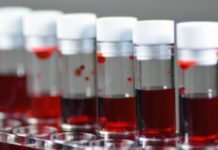 Corona Virüs İle Kan Grupları Arasında Nasıl Bir İlişki Var?