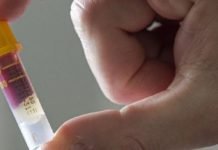 Corona Virüs İçin Oluşan Otoantikorlar Vücuda Zarar Verebiliyor