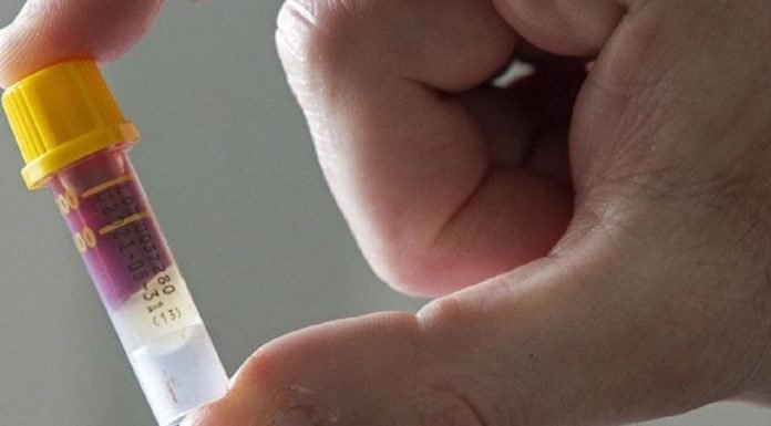 Corona Virüs İçin Oluşan Otoantikorlar Vücuda Zarar Verebiliyor