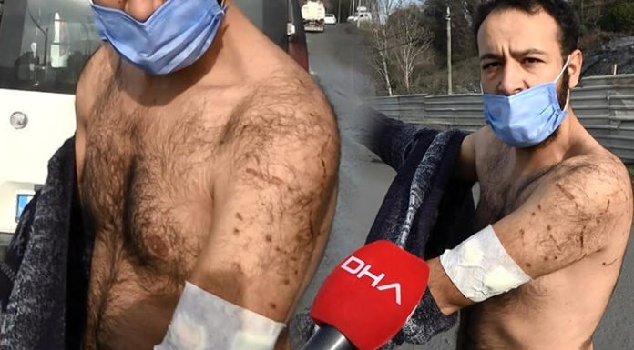 Sultangazi’de Dehşet! Başıboş Köpekler Çobana Saldırdı kopek saldırısı