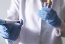 Fransa’da Cep Telefonuyla Yapılan Corona Virüs Testi Geliştirildi