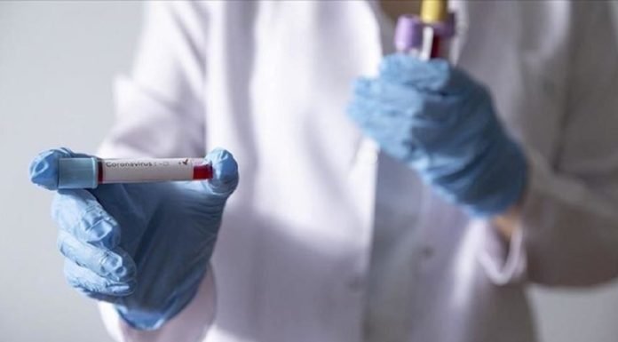 Fransa’da Cep Telefonuyla Yapılan Corona Virüs Testi Geliştirildi