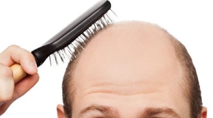 Taylandlı Bilim İnsanları Kellik Sorununu Ortadan Kaldırdıklarını Açıkladı