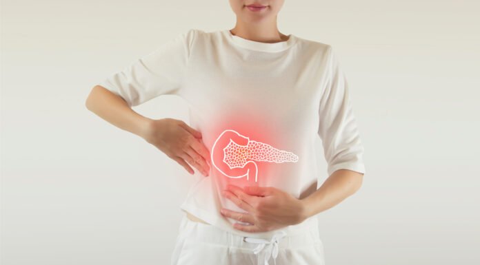 Pankreas Kanseri Tedavisinde Merak Edilen 10 Soru / 10 Yanıt PANKREAS KANSERİ